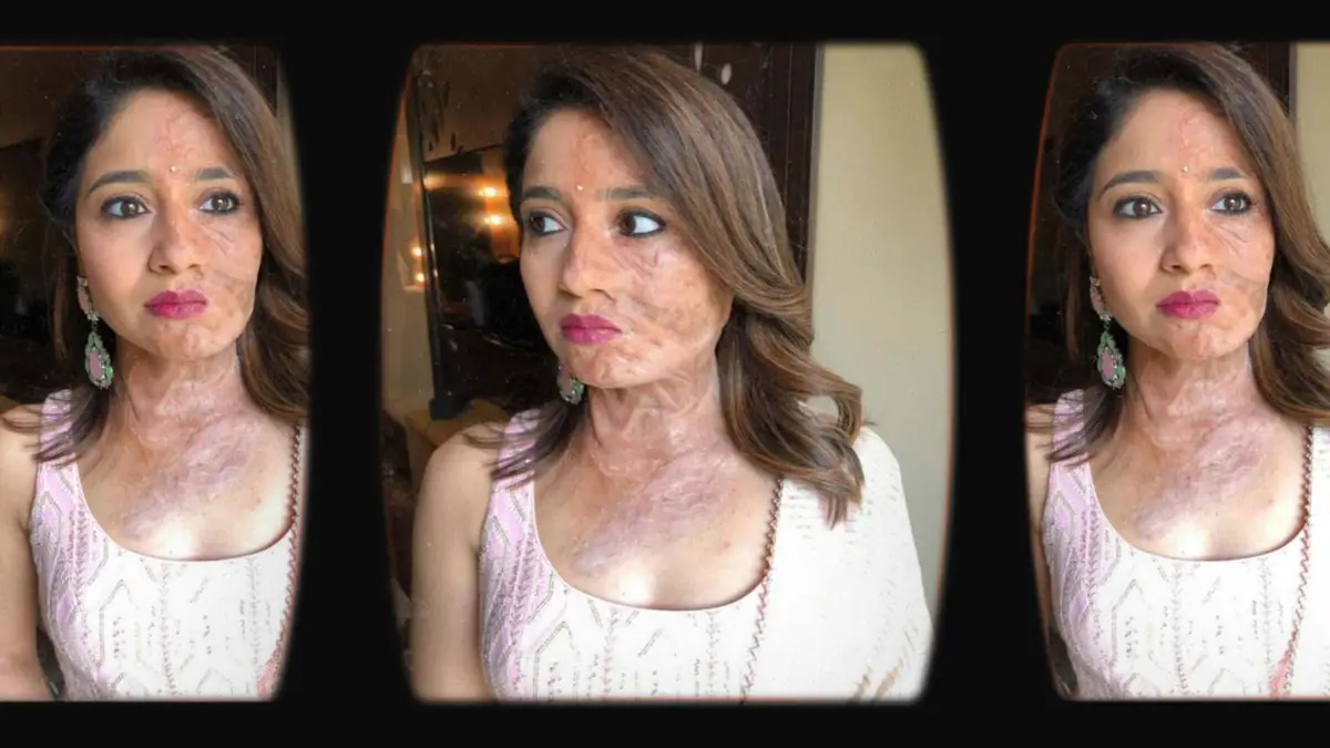 Prosthetic Work portfolio page 3