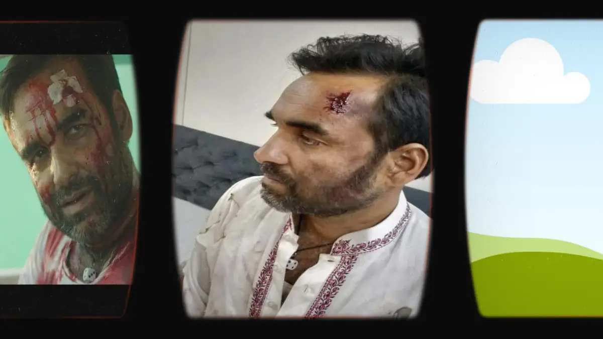 Prosthetic Work portfolio page 4