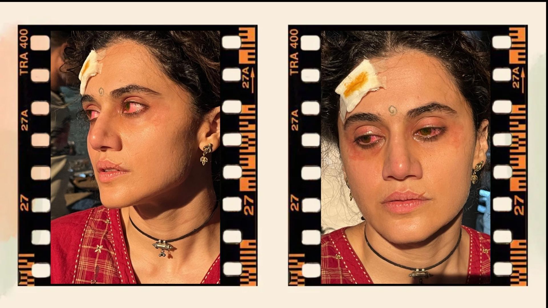 Prosthetic Work portfolio page 23