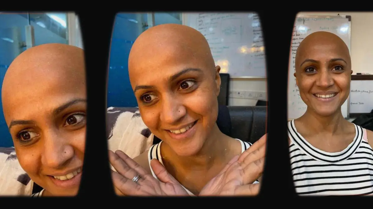 Prosthetic Work portfolio page 24