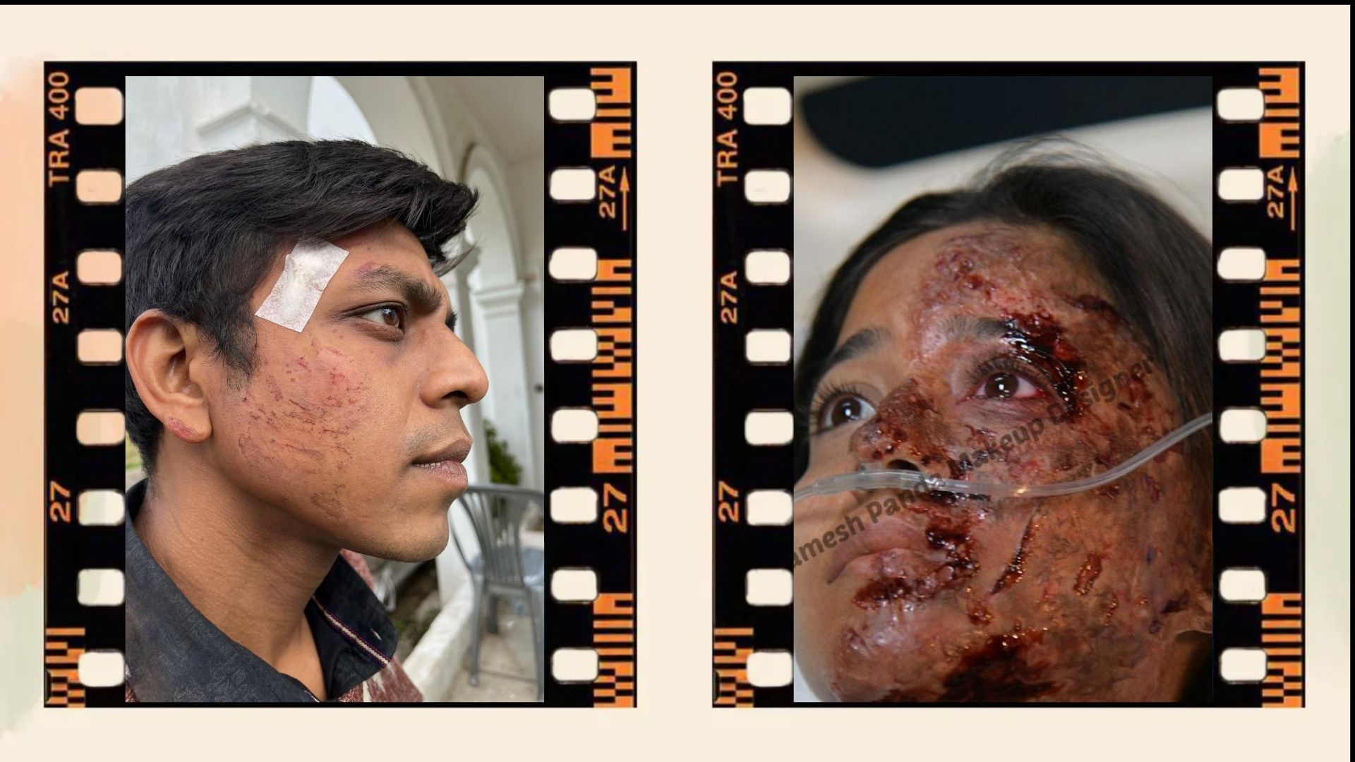 Prosthetic Work portfolio page 31