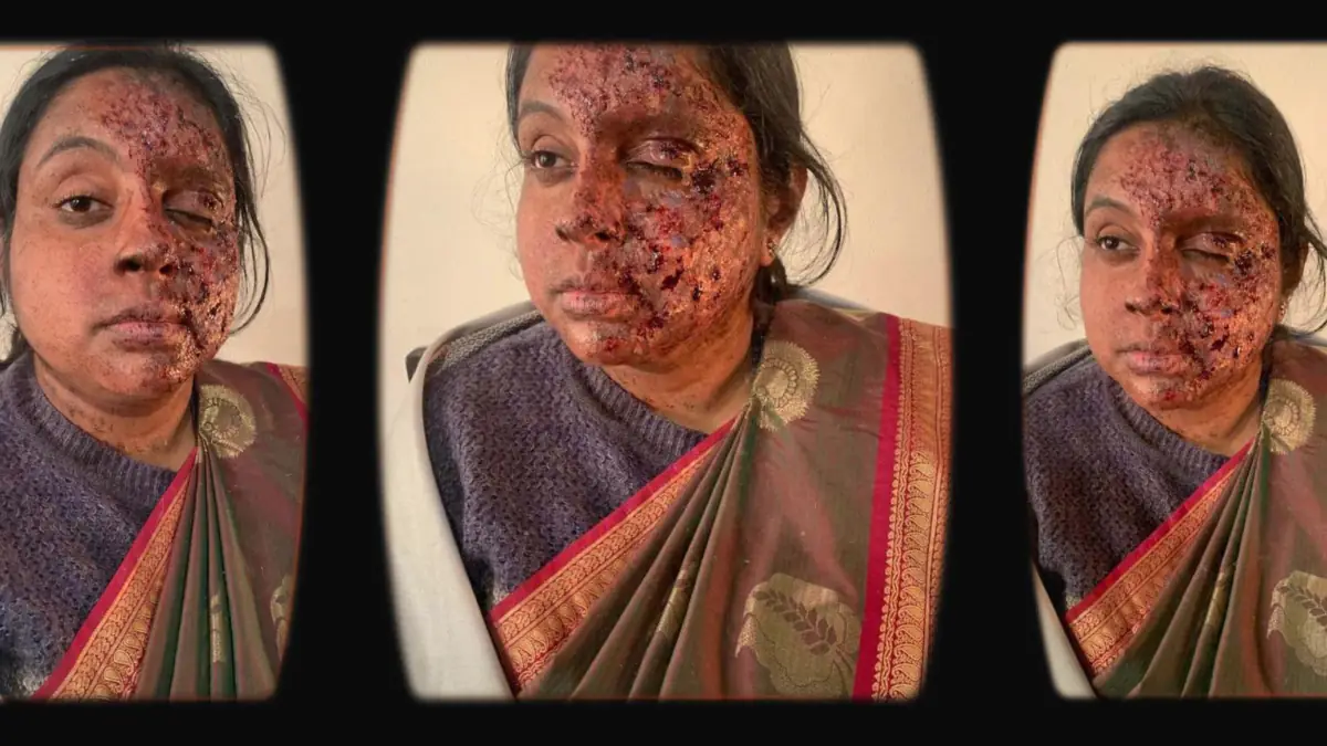 Prosthetic Work portfolio page 34