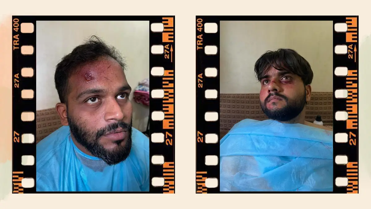 Prosthetic Work portfolio page 35