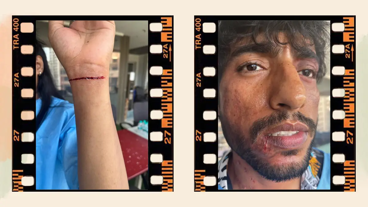 Prosthetic Work portfolio page 37