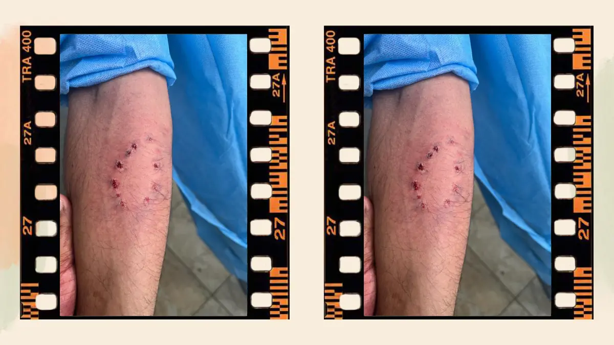 Prosthetic Work portfolio page 39