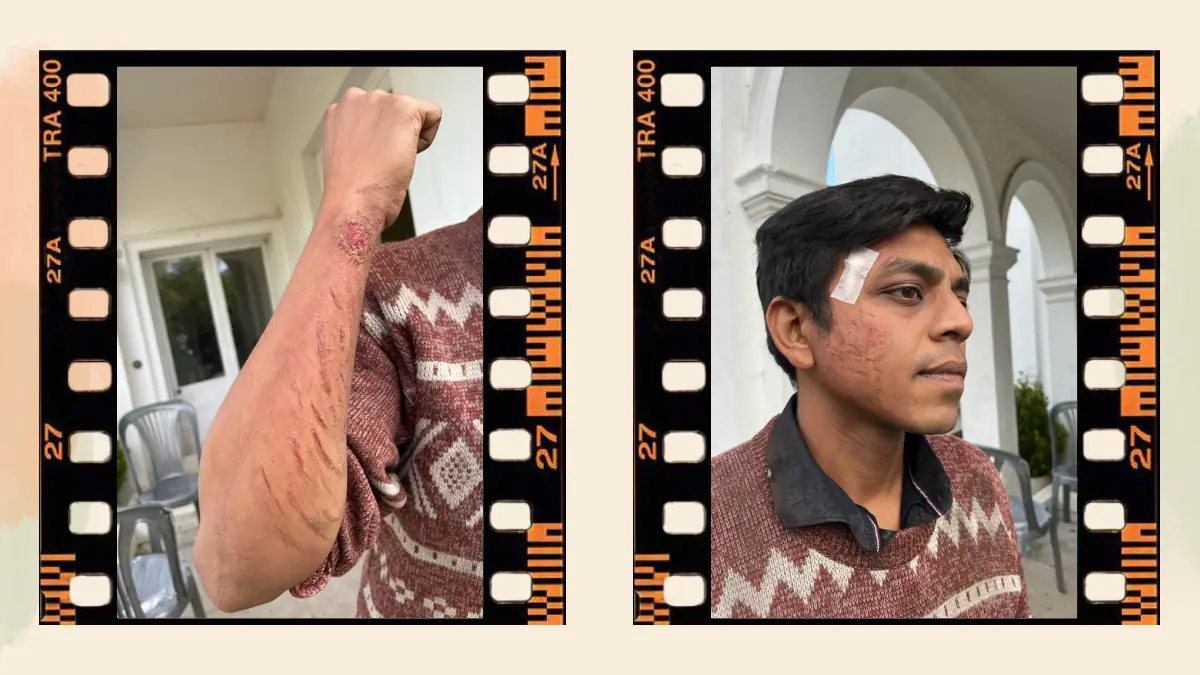 Prosthetic Work portfolio page 49