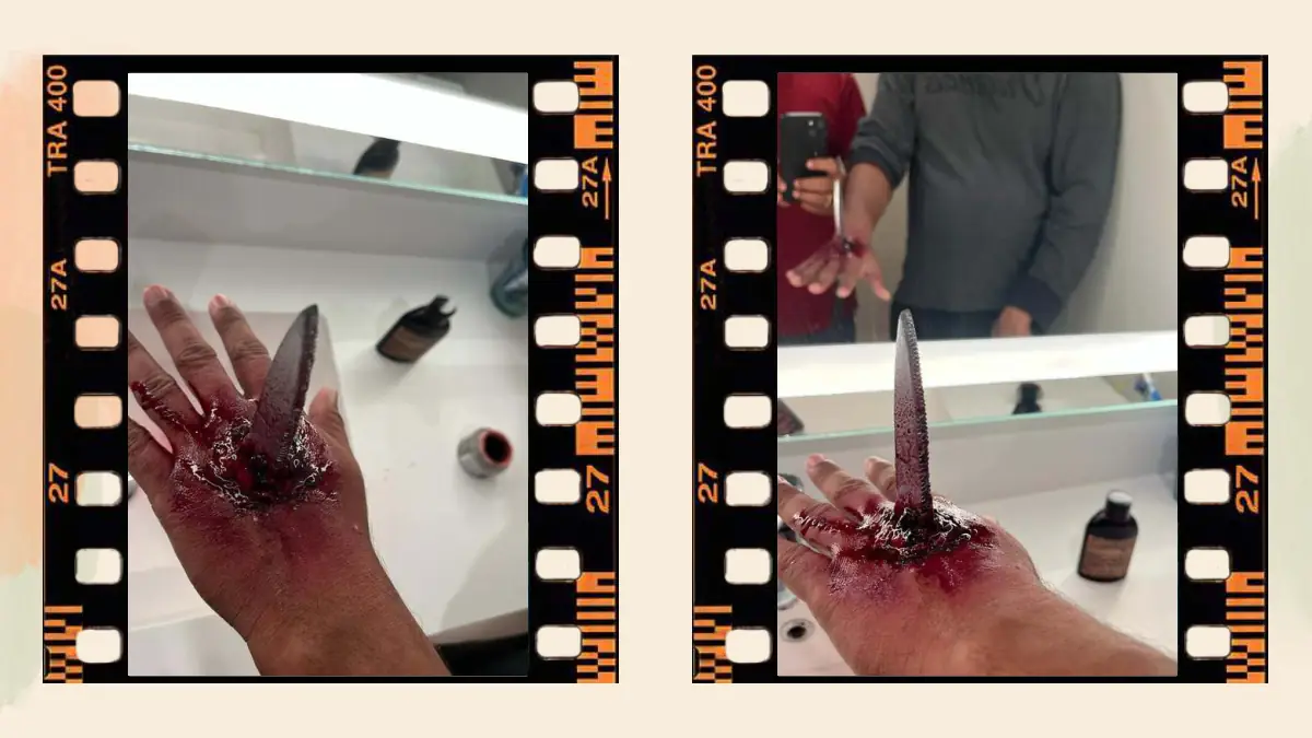 Prosthetic Work portfolio page 52